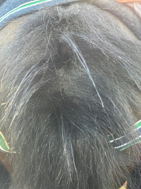 Staart voor gebruik anti-schuur